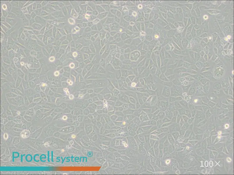 SK-LU-1 Cell Complete Medium - 1