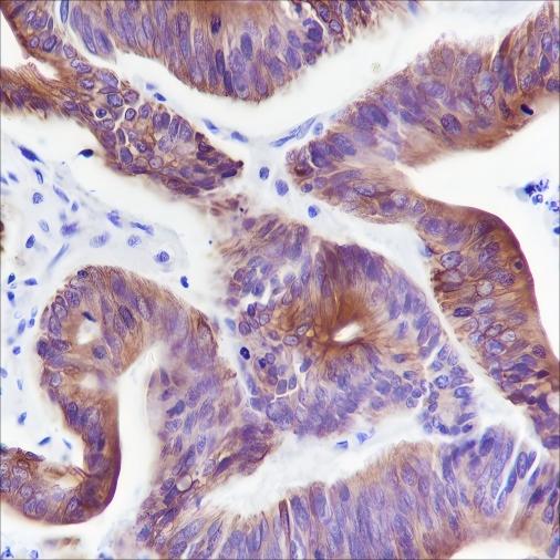 Recombinant Keratin 20 Monoclonal Antibody - small - 3