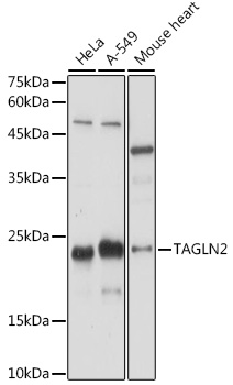 Western blot analysis of extracts of various cell lines using TAGLN2 Polyclonal Antibody at 1:1000 dilution.