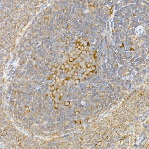 Immunohistochemistry of paraffin-embedded rat spleen using Caspase-12 Polyclonal antibody at dilution of 1:100 (40x lens).Perform high pressure antigen retrieval with 10 mM citrate buffer pH 6.0 before commencing with IHC staining protocol.