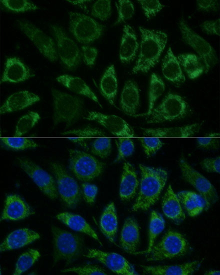 Immunofluorescence analysis of L929 cells using NDUFS8 Polyclonal Antibody at dilution of 1:100 (40x lens). Blue: DAPI for nuclear staining.