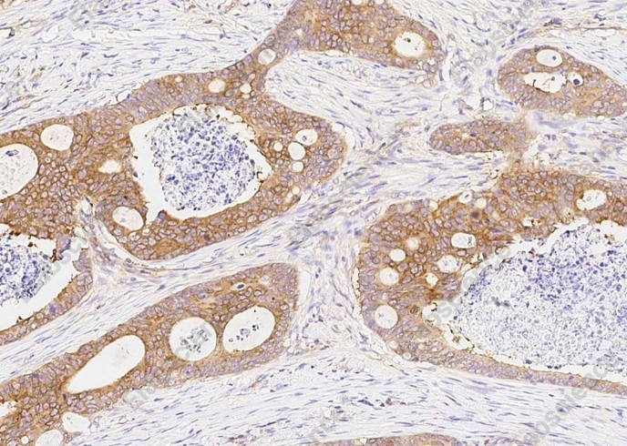 DARS Monoclonal Antibody - 1