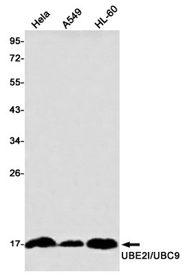 Western blot detection of UBE2I/UBC9 in Hela,A549,HL-60 using UBE2I/UBC9 Rabbit mAb(1:1000 diluted)