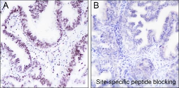 Recombinant Histone H3 (Di Methyl Lys14) Monoclonal Antibody - 3