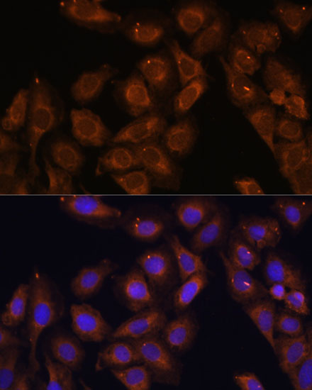 Immunofluorescence analysis of U-2 OS cells using UPF1 Polyclonal Antibody at dilution of  1:100. Blue: DAPI for nuclear staining.