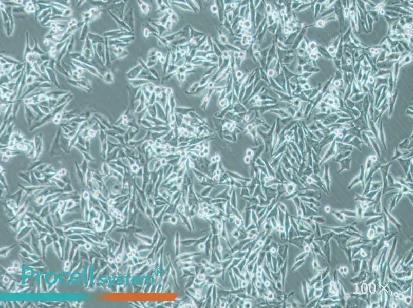 SK-MEL-5 Cell Complete Medium - 1
