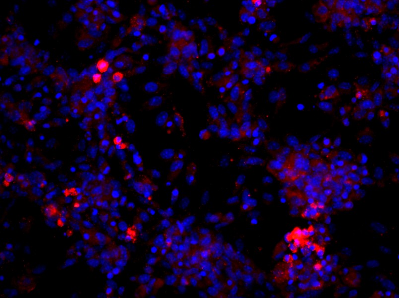 Mouse Dermal Microvascular Endothelial Cell Complete Medium - 4