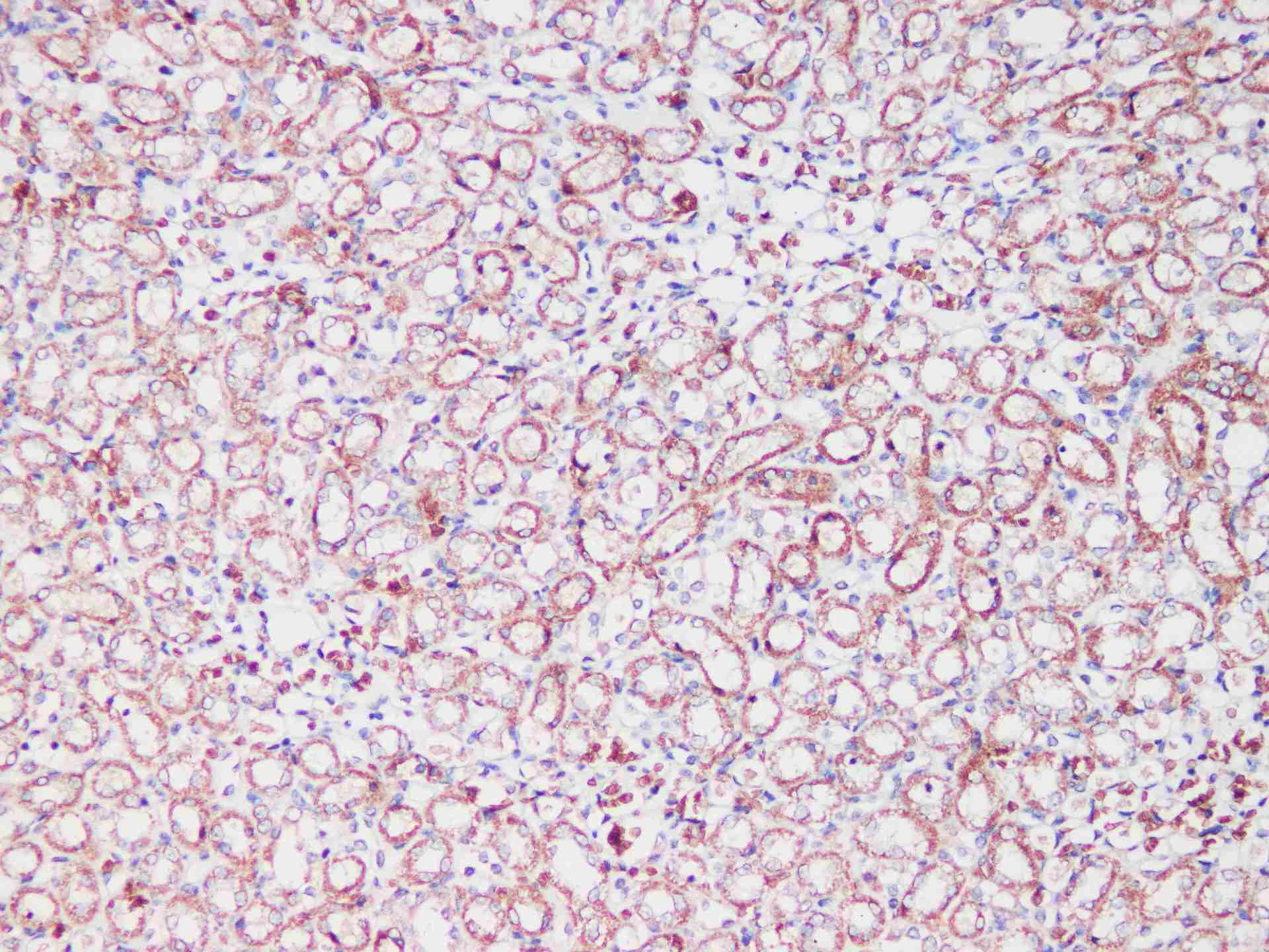 SDHA Polyclonal Antibody - small - 4