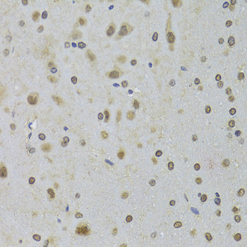 Immunohistochemistry of paraffin-embedded Rat brain using DDX1 Polyclonal Antibody at dilution of  1:100 (40x lens).