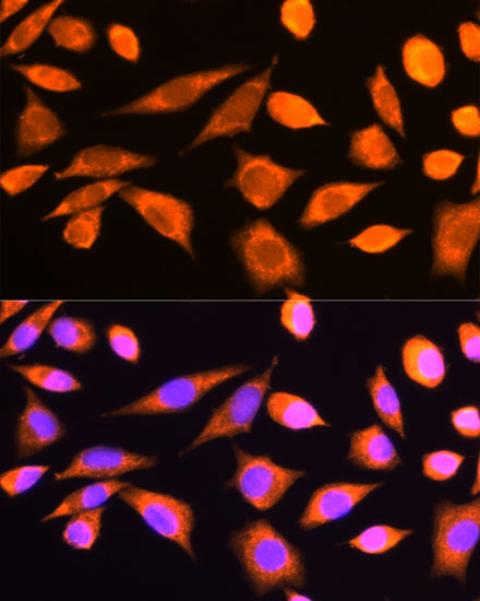 Immunofluorescence analysis of L929 cells using RPS20 Polyclonal Antibody at dilution of  1:100. Blue: DAPI for nuclear staining.