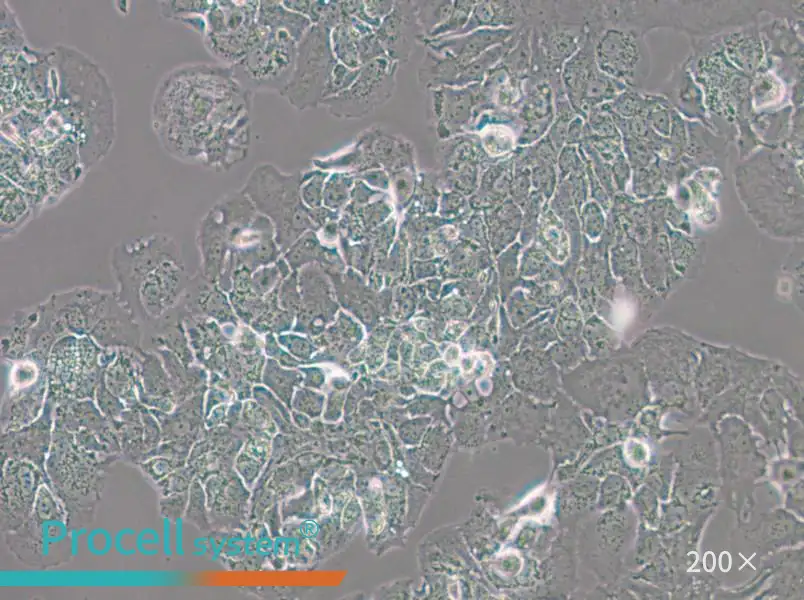MDA-MB-415 (DMEM) Cell Complete Medium - small - 6
