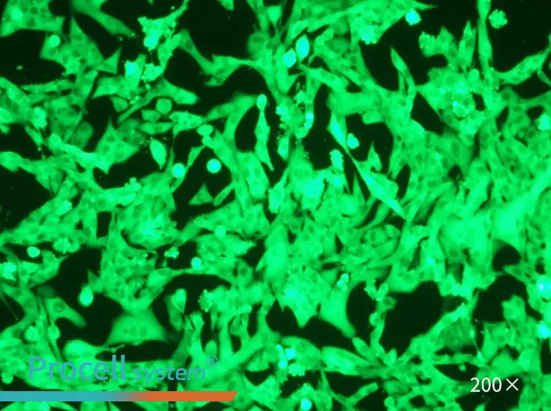 NCI-H446-GFP Cell Complete Medium - 6