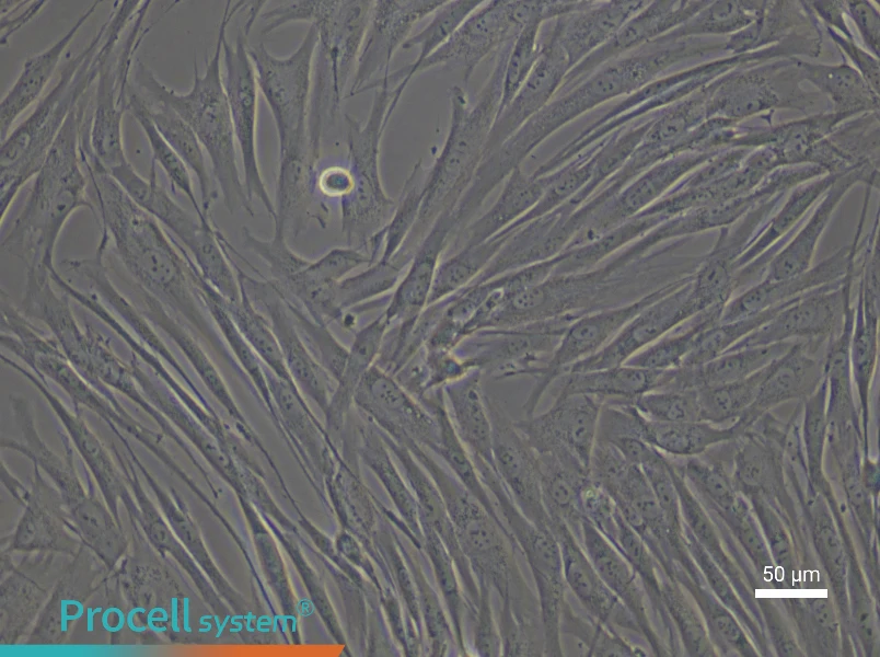 Human Colonic Fibroblast Complete Medium - 6