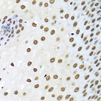 Immunohistochemistry of paraffin-embedded Human esophagus using XRCC5 Polyclonal Antibody at dilution of 1:100 (40x lens).