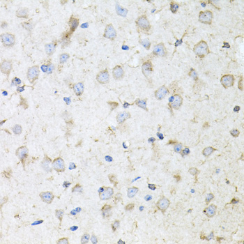 Immunohistochemistry of paraffin-embedded Mouse brain using KLK11 Polyclonal Antibody at dilution of  1:100 (40x lens).