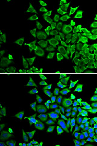 Immunofluorescence analysis of HeLa cells using BAD Polyclonal Antibody