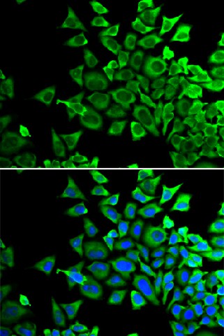 Immunofluorescence analysis of HeLa cells using BAD Polyclonal Antibody