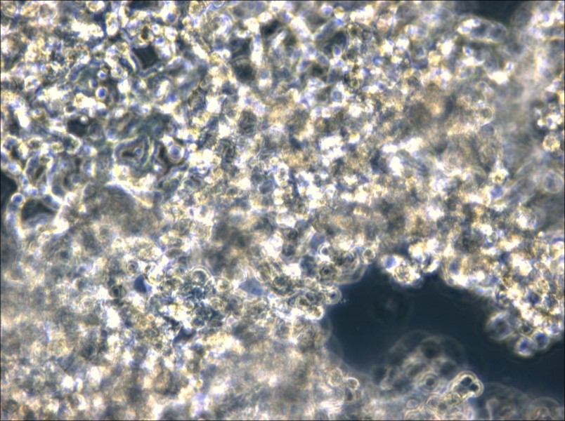 NCI-H526 Cell Complete Medium - small - 5