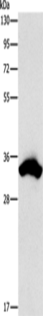 Western Blot analysis of 293T cell using CDCA8 Polyclonal Antibody at dilution of 1:900