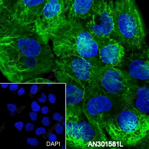 Recombinant Keratin 5/6 Monoclonal Antibody - 6