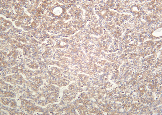 Recombinant Phospho-eIF2α (Ser51) Monoclonal Antibody - small - 2