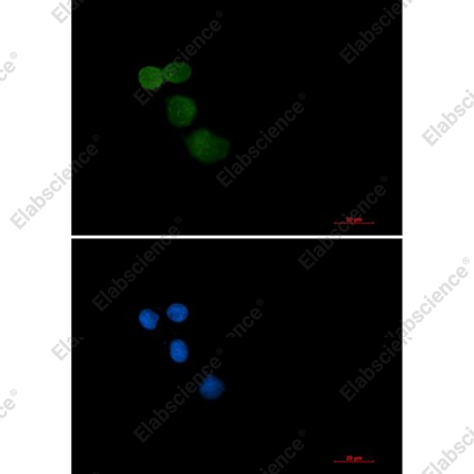 Recombinant Ubiquitin Protein Ligase E3A Monoclonal Antibody - 4