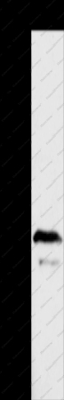 ADAP1 Polyclonal Antibody - 1