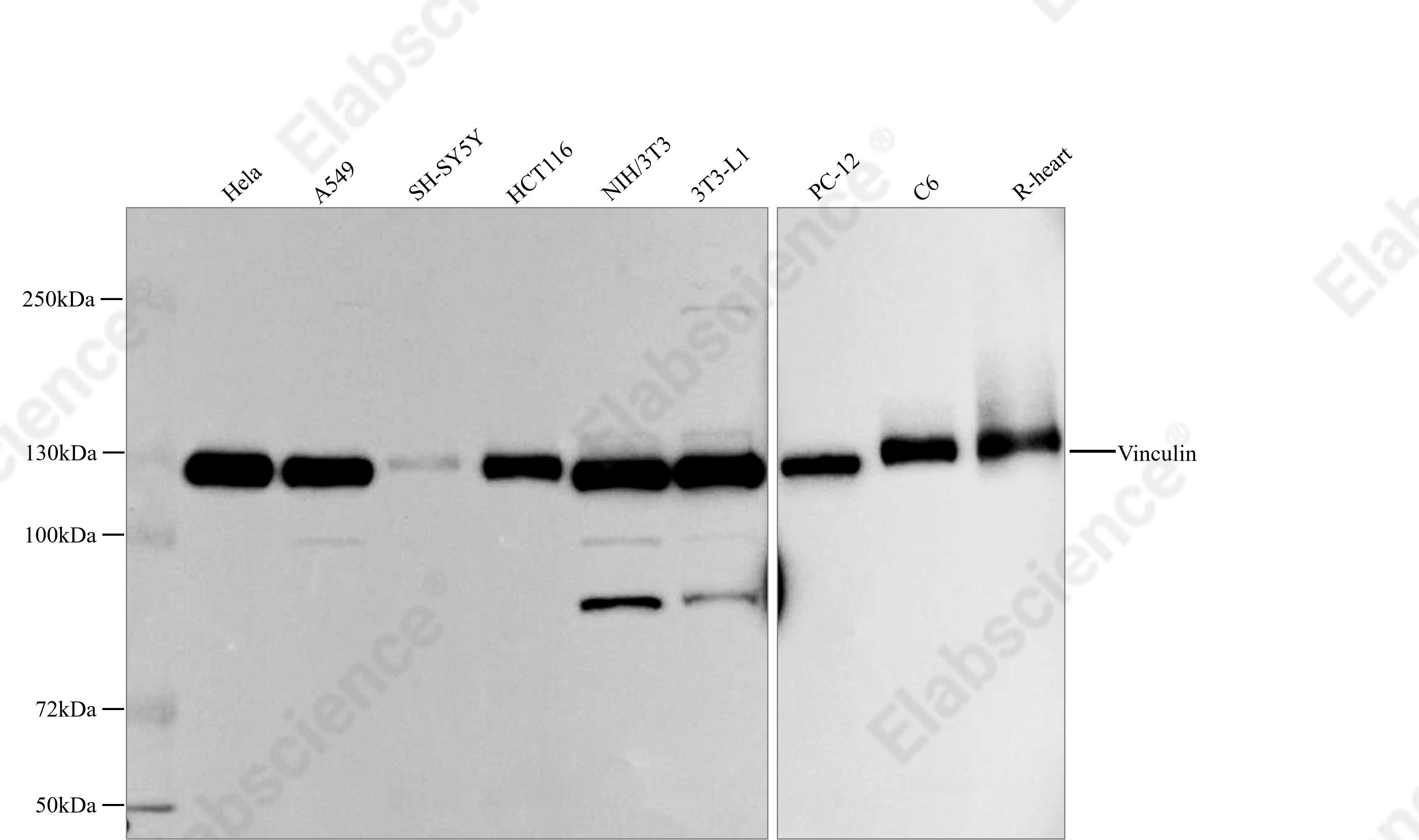 Recombinant Vinculin Monoclonal Antibody - 1
