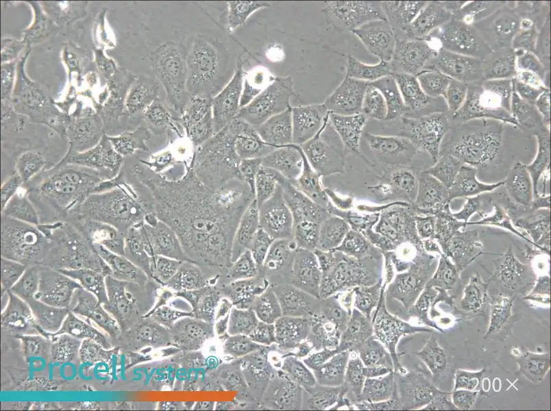 NCI-H1693 Cell Complete Medium - 5