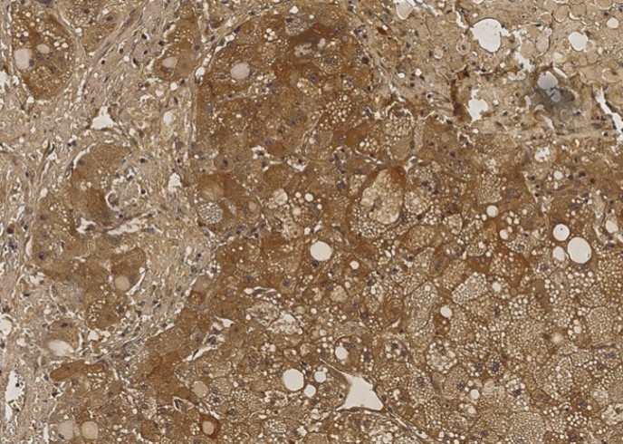 Recombinant NME1/NDKA Monoclonal Antibody - small - 2
