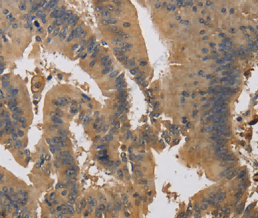 KIF22 Polyclonal Antibody - 2