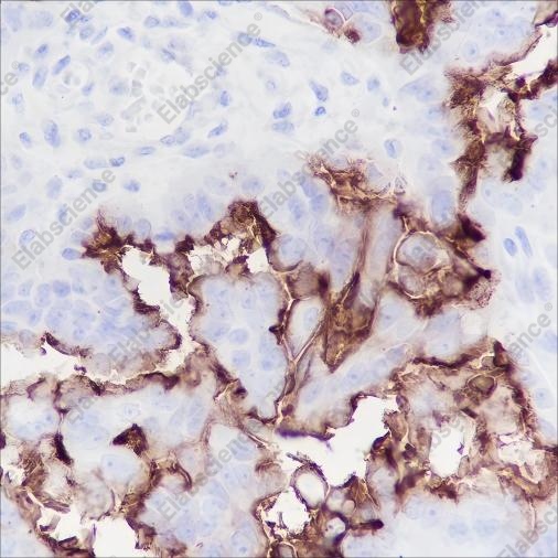 Recombinant NaPi2b Monoclonal Antibody - 2