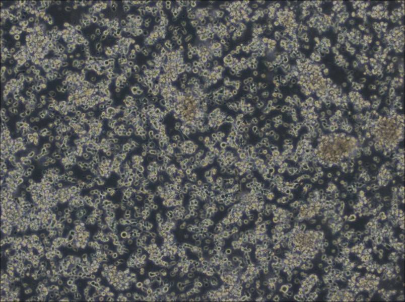 HCC38 BL Cell Complete Medium-searchlist-1