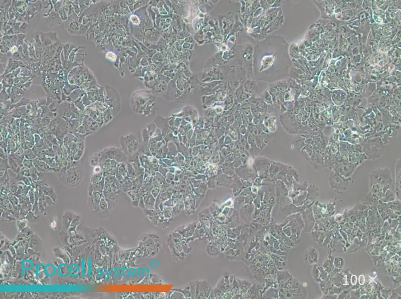 MDA-MB-415 (DMEM) Cell Complete Medium - 1