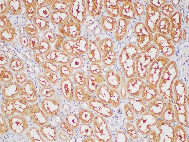 Immunohistochemistry of paraffin-embedded Human kidney using GAPDH Polyclonal Antibody at dilution of 1:400