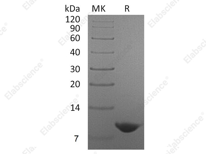 Recombinant Human Nucleobindin-2/NUCB2 Protein - 1