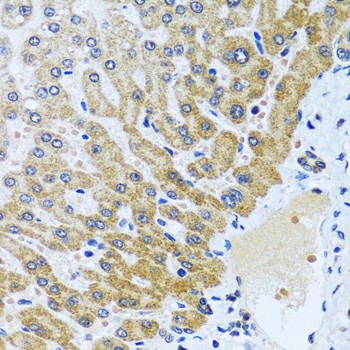 Immunohistochemistry of paraffin-embedded Human liver using CPA6 Polyclonal Antibody at dilution of  1:100 (40x lens).