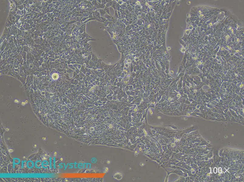 LCLC-97TM1 Cell Complete MediumLCLC-97TM1 Cell Complete Medium - 2