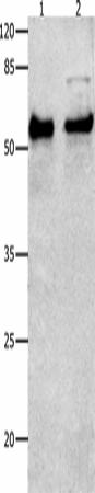 Western Blot analysis of Human liver cancer tissue and Hela cells using SMAD4 Polyclonal Antibody at dilution of 1:150