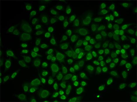 Immunofluorescence analysis of MCF-7 cells using RAD54L2 Polyclonal Antibody