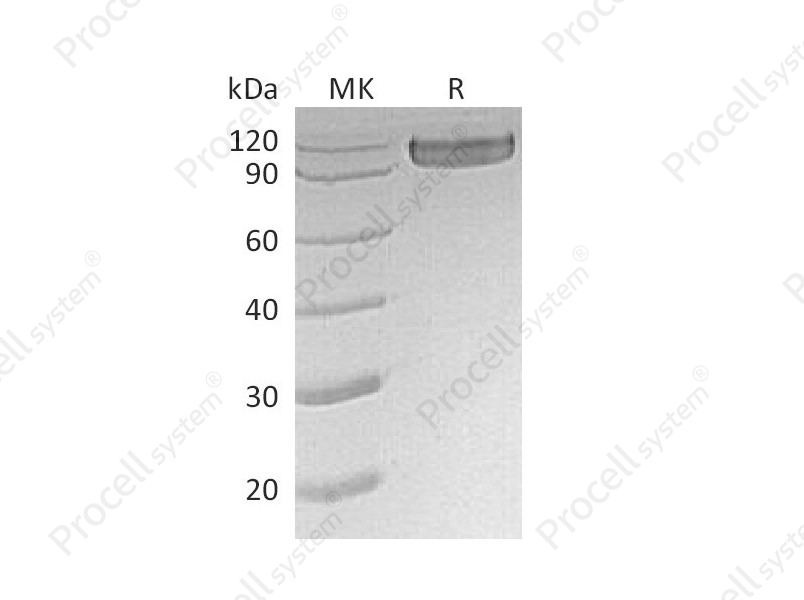 CD30/TNFRSF8 (C-Fc), Human, Recombinant