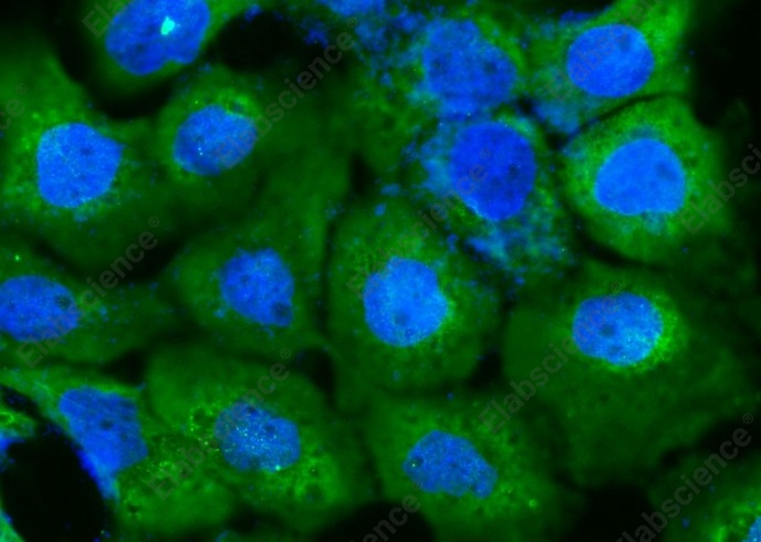 DARS Monoclonal Antibody - 2