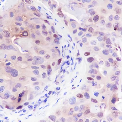 Recombinant PAX9 Monoclonal Antibody - small - 2