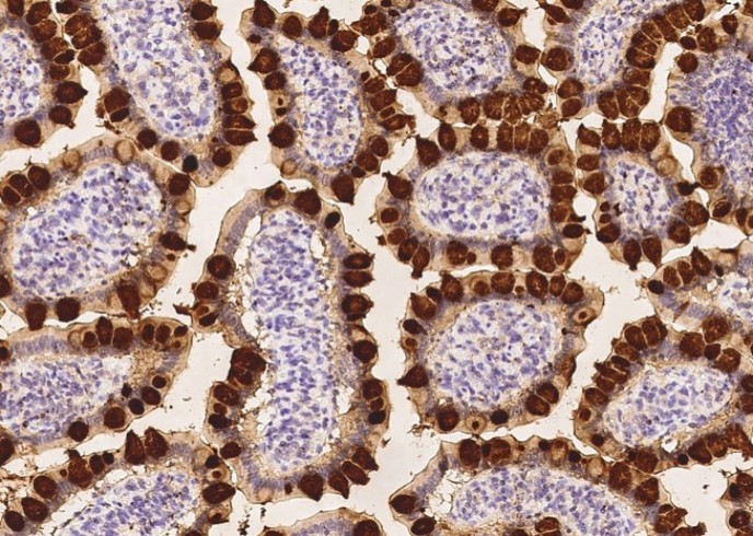 Recombinant REG4 Monoclonal Antibody - small - 2