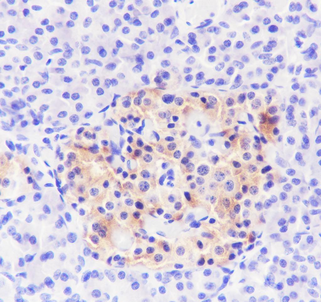 Recombinant SV2A Monoclonal Antibody - small - 3
