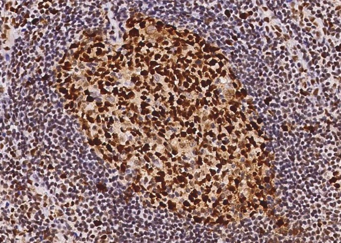 Recombinant PCNA Monoclonal Antibody - small - 4