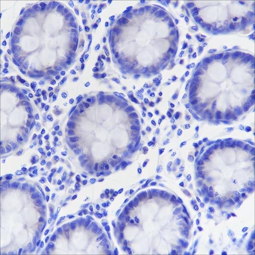 Recombinant Napsin A Monoclonal Antibody-searchlist-1
