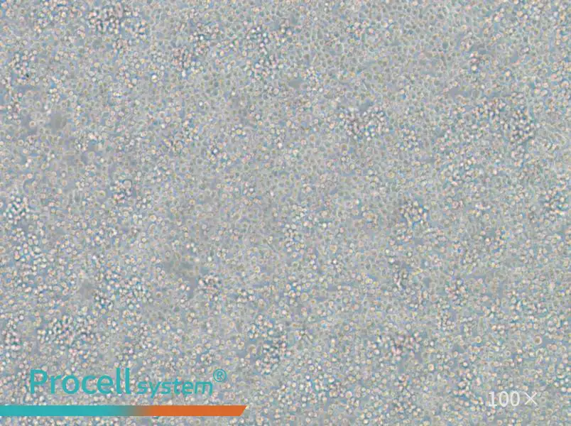 WIL2 S Cell Complete Medium - 1