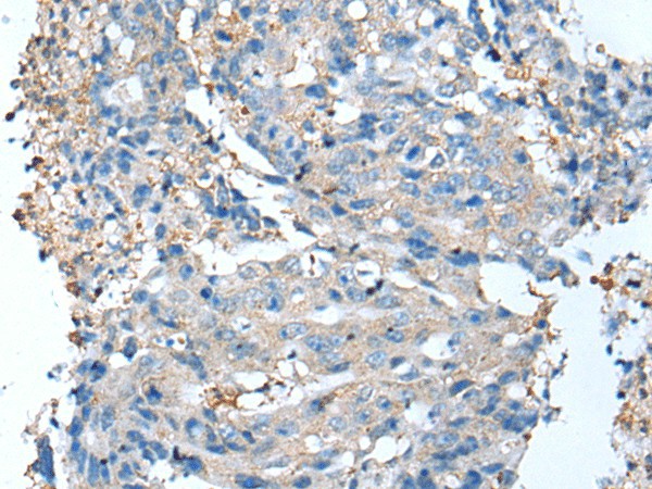 DCX Polyclonal Antibody - small - 3