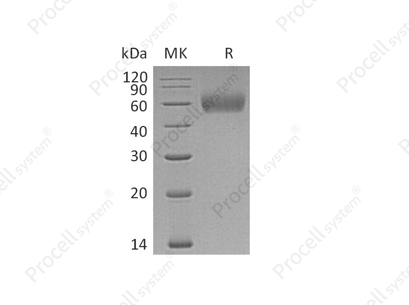 IL-1R-2/CD121b, Human, Recombinant